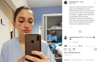 Coronavirus, selfie virale dell'infermiera: Fate la vostra parte