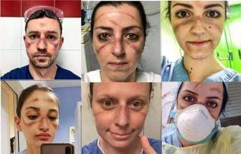 Infermieri in trincea, ecco i volti tumefatti dal superlavoro Infermieri in trincea, ecco i volti tumefatti dal superlavoro