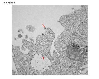 Ecco le prime foto del coronavirus lombardo Ecco le prime foto del coronavirus lombardo