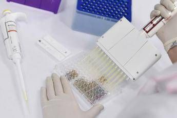 Coronavirus, nel mondo quasi 1,5 milioni di contagi Coronavirus, nel mondo quasi 1,5 milioni di contagi