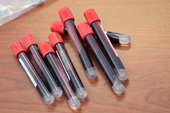 Coronavirus, una speranza dal sangue dei guariti Coronavirus, una speranza dal sangue dei guariti
