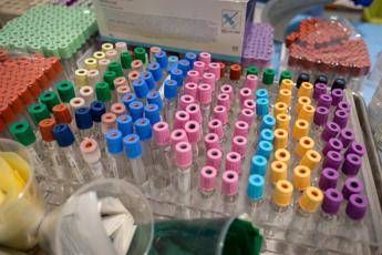 Zampa: Virus non c'è più? Confonde gli italiani Zampa: Virus non c'è più? Confonde gli italiani