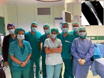 Operazione record, ricostruita caviglia di una bambina di 9 anni Operazione record, ricostruita caviglia di una bambina di 9 anni