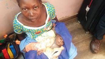 Dall'Africa a Roma, il viaggio delle gemelline siamesi. La mamma: Spero studino medicina Dall'Africa a Roma, il viaggio delle gemelline siamesi. La mamma: Spero studino medicina