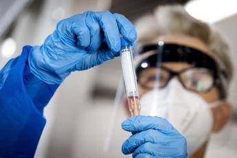 Coronavirus, nel mondo oltre 25 milioni di contagi Coronavirus, nel mondo oltre 25 milioni di contagi