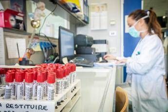 Coronavirus, in Lombardia 91 nuovi casi e 4 morti Coronavirus, in Lombardia 91 nuovi casi e 4 morti