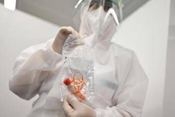 Coronavirus, in Lombardia 119 nuovi casi e nessun decesso Coronavirus, in Lombardia 119 nuovi casi e nessun decesso