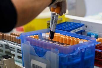 Coronavirus, in Sardegna 139 nuovi casi e un morto Coronavirus, in Sardegna 139 nuovi casi e un morto