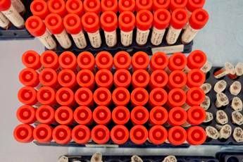 Variante Covid, Oms: Rischio test meno efficaci Variante Covid, Oms: Rischio test meno efficaci