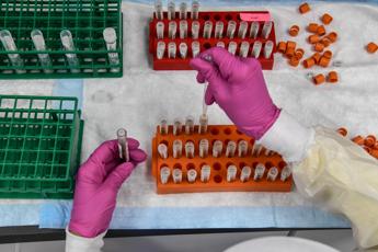 Covid, falsi positivi all'Hiv: Australia ferma test vaccino