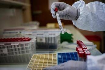 Vaccini, Codacons denuncia Germania per violazione regole Ue Vaccini, Codacons denuncia Germania per violazione regole Ue