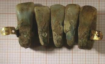 Scoperta una dentiera di quattro secoli fa Scoperta una dentiera di quattro secoli fa