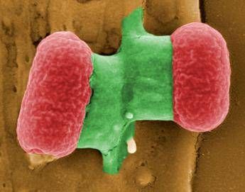 Allarme superbatteri dalla Cina. Il mondo è sull'orlo dell'era post-antibiotici? Allarme superbatteri dalla Cina. Il mondo è sull'orlo dell'era post-antibiotici?