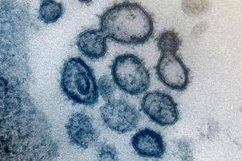 Coronavirus, ecco l'immagine del virus realizzata negli Usa