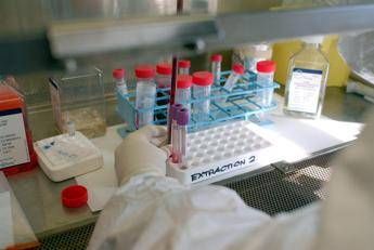 "Virus rallenta ma plateau resiste, ecco perché" Coronavirus provette Fg - "Virus rallenta ma plateau resiste, ecco perché"