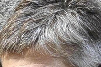 Ecco perché lo stress fa venire capelli bianchi Ecco perché lo stress fa venire capelli bianchi