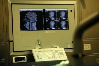 Da ricerca italiana speranza contro malattie neurodegenerative Da ricerca italiana speranza contro malattie neurodegenerative