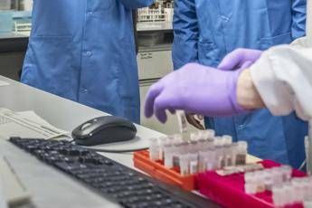 Coronavirus, Burioni: Da cartone a plastica ecco quanto resiste sugli oggetti Coronavirus, Burioni: Da cartone a plastica ecco quanto resiste sugli oggetti