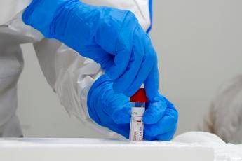 Coronavirus, stop Antitrust a sito che commercializza test rapido Coronavirus, stop Antitrust a sito che commercializza test rapido