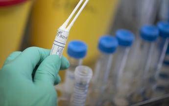 Coronavirus, G7: Impegno per forte risposta globale Coronavirus, G7: Impegno per forte risposta globale