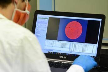 Coronavirus, Lopalco: Aumento test buon segno, ricerca più attiva dei casi Coronavirus, Lopalco: Aumento test buon segno, ricerca più attiva dei casi