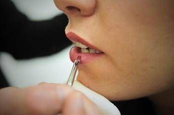 Dal filler al 'lip lift', le 5 tecniche per ottenere labbra più carnose Dal filler al 'lip lift', le 5 tecniche per ottenere labbra più carnose