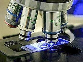 Ricerca: identificato nuovo gene che causa la Sla, studio italiano Ricerca: identificato nuovo gene che causa la Sla, studio italiano