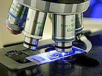 Identificato nuovo gene che causa la Sla, studio italiano Identificato nuovo gene che causa la Sla, studio italiano