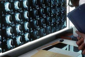 Sani o malati? Linee guida Gimbe contro iper-diagnosi Sani o malati? Linee guida Gimbe contro iper-diagnosi