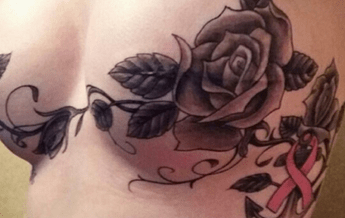 Hanno contenuti sessuali, Instagram cancella i tatuaggi post-mastectomia Hanno contenuti sessuali, Instagram cancella i tatuaggi post-mastectomia
