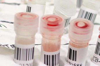 Coronavirus Lazio, 10mila test al giorno per indagine sierologica