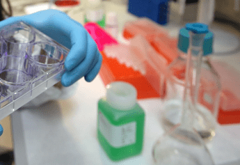 Cancro colon, coppia anticorpi raddoppia sopravvivenza per malati gravi Cancro colon, coppia anticorpi raddoppia sopravvivenza per malati gravi