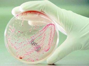 Allarme Escherichia coli a Como, 3 bimbi con sindrome emolitico-uremica Allarme Escherichia coli a Como, 3 bimbi con sindrome emolitico-uremica