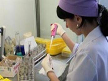 Aids, studio italiano: ecco dove l'Hiv si nasconde nelle cellule Aids, studio italiano: ecco dove l'Hiv si nasconde nelle cellule