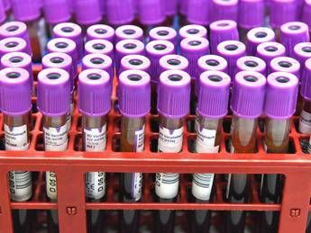 Rh negativo sangue alieno, sul web corre la bizzarra teoria. L'esperto: Folle Rh negativo sangue alieno, sul web corre la bizzarra teoria. L'esperto: Folle