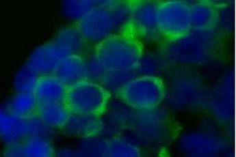 Scoperta italiana choc: Dna 'alieno' in un malato di leucemia acuta su 2 Scoperta italiana choc: Dna 'alieno' in un malato di leucemia acuta su 2