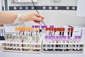 siti Web di incontri per ppl con herpes