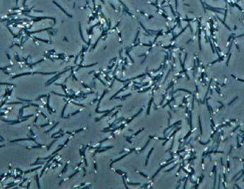 Batteri dell'intestino 'chiave' per cure anticancro più efficaci Batteri dell'intestino 'chiave' per cure anticancro più efficaci