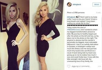 #BitingBack, su Instagram prima e dopo la vittoria sull'anoressia /Foto #BitingBack, su Instagram prima e dopo la vittoria sull'anoressia /Foto